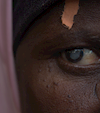 Khadija’s Cataract Surgery: Restoring Sight & Hope